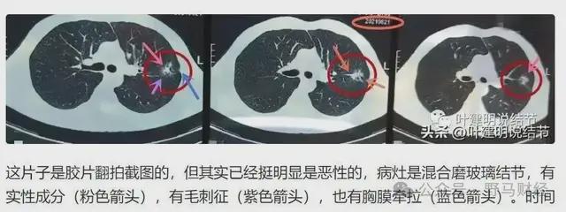 爱康国宾二次声明“漏癌”无责，女律师发出7大灵魂拷问！